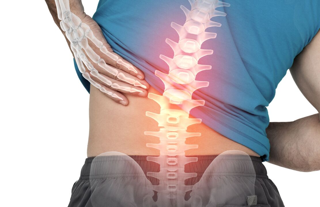 Lomber'in ostekondroz tehlikesi
