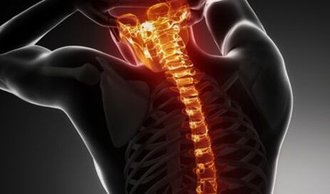 Tüm omurganın osteokondrozu