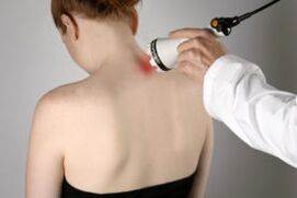 Servikal osteokondrozun lazer tedavisi ile tedavisi